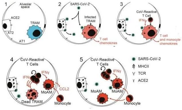 Circuits between infected macrophages and T cells in SARS-CoV-2 pneumonia