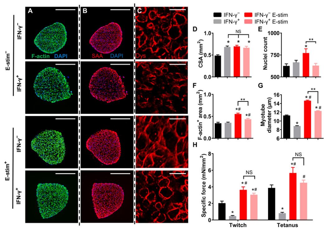 E-刺激可防止IFN-γ引起的肌管長(zhǎng)度，肌小節(jié)豐度和收縮蛋白表達(dá)減少